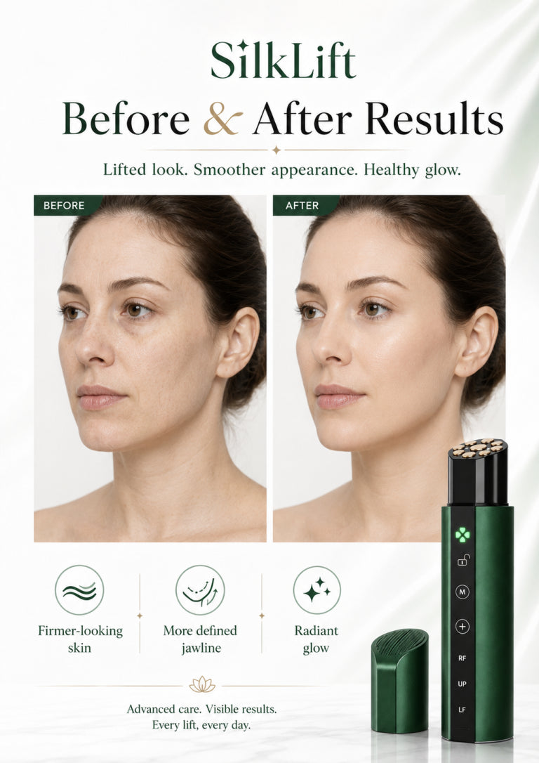 SilkLift Before and After — Lifted Look